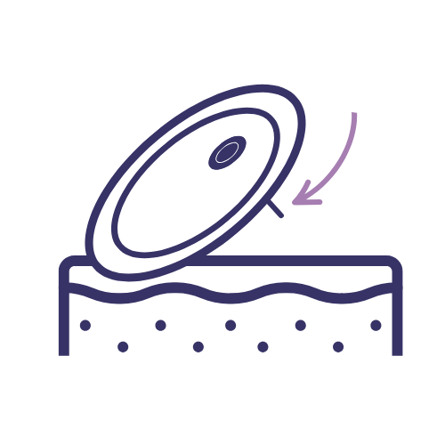 CGM sensor